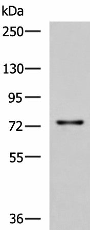 TGFBI Polyclonal Antibody – Figure 1 of 3