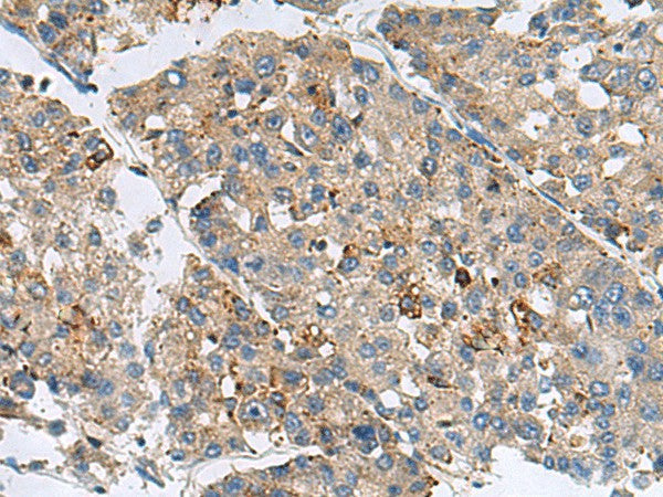 MED31 Polyclonal Antibody – Figure 1 of 3