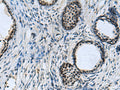CCAR2 Polyclonal Antibody – Figure 1 of 3