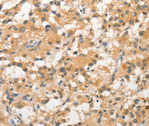 STAM Polyclonal Antibody – Figure 1 of 3