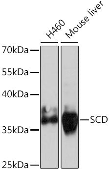(KO Validated) SCD Polyclonal Antibody – Figure 1 of 6