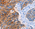 CLEC2B Polyclonal Antibody – Figure 1 of 2