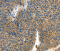 COL4A2 Polyclonal Antibody – Figure 1 of 3