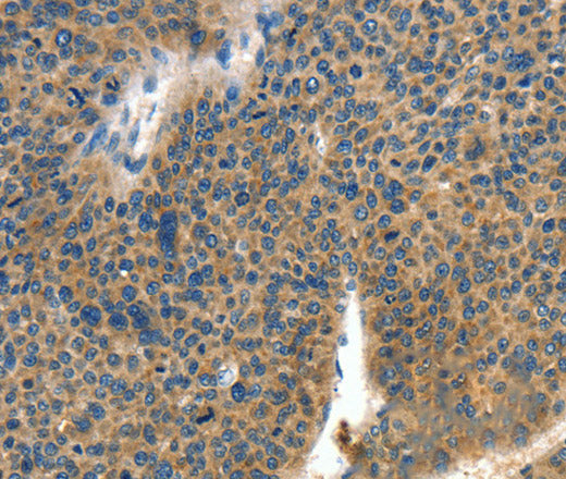 COL4A2 Polyclonal Antibody – Figure 1 of 3