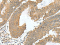 RAB23 Polyclonal Antibody – Figure 1 of 3