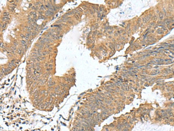RAB23 Polyclonal Antibody – Figure 1 of 3