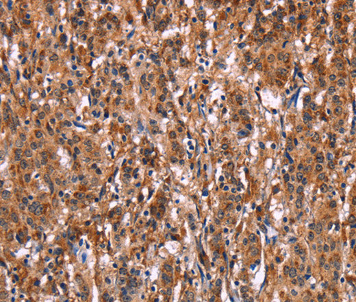 LILRB1 Polyclonal Antibody – Figure 1 of 3
