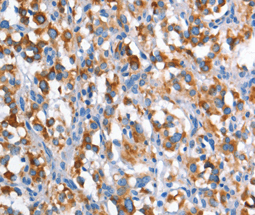 CD226 Polyclonal Antibody – Figure 1 of 3