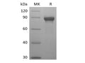 Recombinant Human Siglec-8 (C-mFc) – Figure 1 of 2