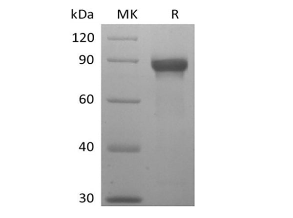 Recombinant Human Siglec-8 (C-mFc) – Figure 1 of 2