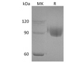Recombinant Human PIGR Protein (His Tag) – Figure 1 of 2