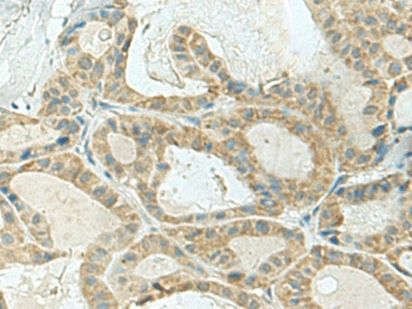 KLC2 Polyclonal Antibody – Figure 1 of 2