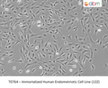 Immortalized Human Endometriotic Cell Line (12Z) | Applied Biological Materials (abm)