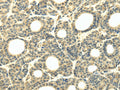 WDR45B Polyclonal Antibody – Figure 1 of 2