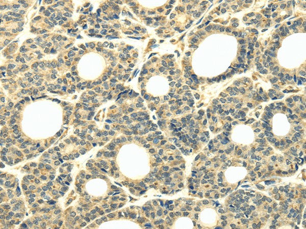 WDR45B Polyclonal Antibody – Figure 1 of 2