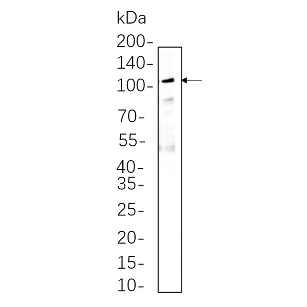U-Blot® Ezrin Rabbit Monoclonal Antibody – Figure 1 of 1