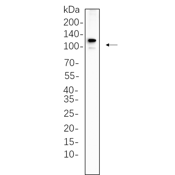 U-Blot® PMS2 Rabbit Monoclonal Antibody – Figure 1 of 1