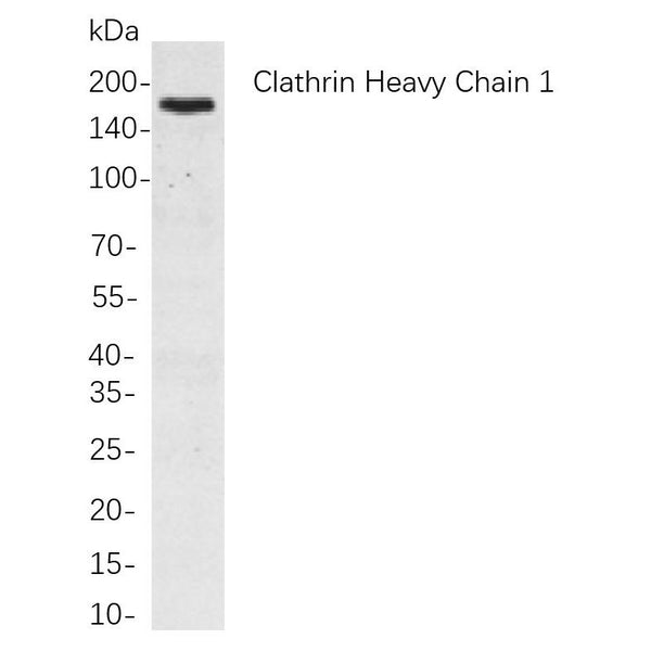 U-Blot® Tuberin Rabbit Monoclonal Antibody – Figure 1 of 1