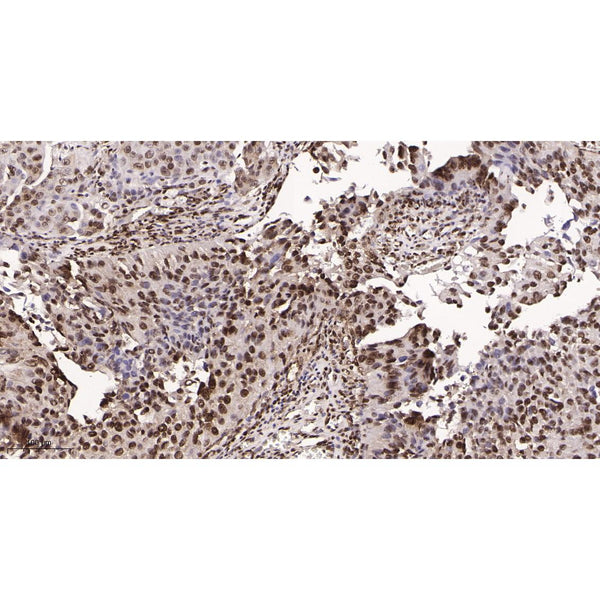 U-Blot® Survivin Rabbit Monoclonal Antibody – Figure 1 of 1