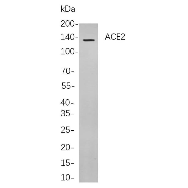 U-Blot® Neuropilin 1 Rabbit Monoclonal Antibody – Figure 1 of 1