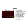 U-Blot® SOD2 Rabbit Monoclonal Antibody – Figure 1 of 2