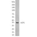 U-Blot® UCP1 Rabbit Monoclonal Antibody – Figure 1 of 1