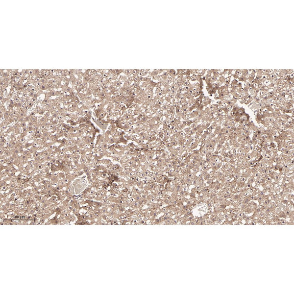 U-Blot® LAMP1 Rabbit Monoclonal Antibody – Figure 1 of 2