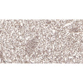 U-Blot® MITF Rabbit Monoclonal Antibody – Figure 1 of 3