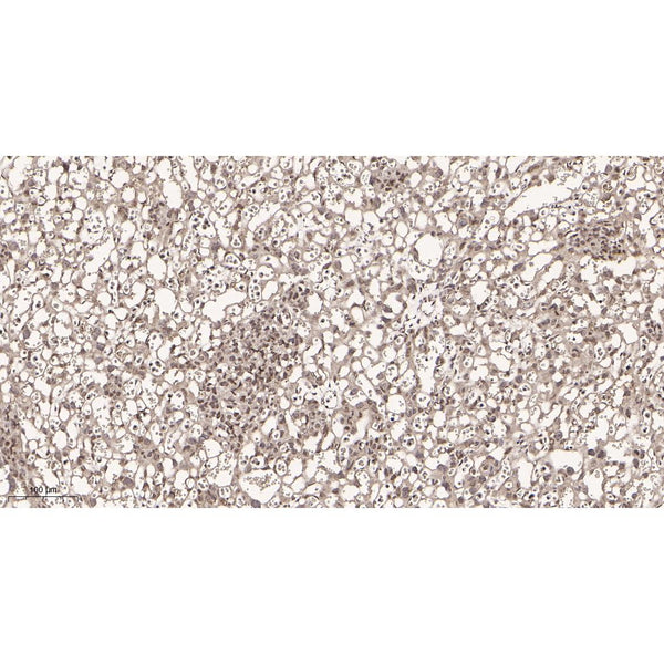 U-Blot® MITF Rabbit Monoclonal Antibody – Figure 1 of 3