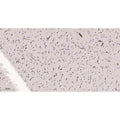 U-Blot® FGFR1 Rabbit Monoclonal Antibody – Figure 2 of 2