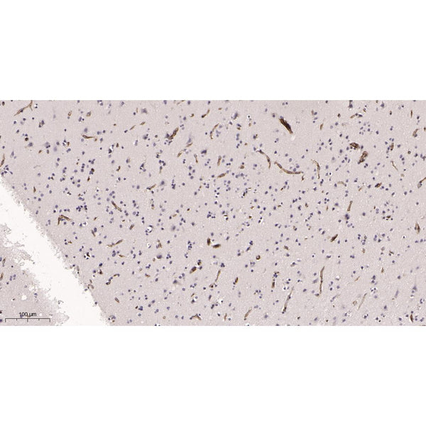 U-Blot® FGFR1 Rabbit Monoclonal Antibody – Figure 2 of 2
