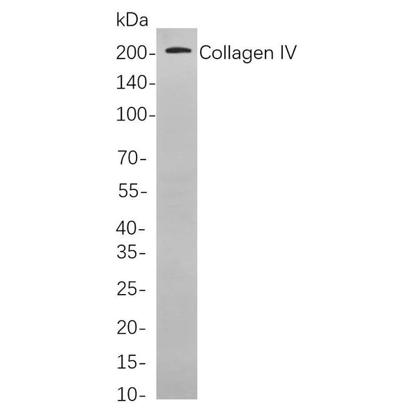 U-Blot® Collagen IV Rabbit Monoclonal Antibody – Figure 1 of 1