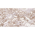 U-Blot® Zap-70 (Phospho Tyr319)/Syk (Phospho Tyr352) Rabbit Monoclonal Antibody – Figure 1 of 2