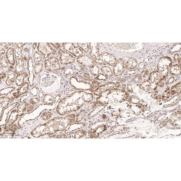 U-Blot® Zap-70 (Phospho Tyr319)/Syk (Phospho Tyr352) Rabbit Monoclonal Antibody – Figure 1 of 2