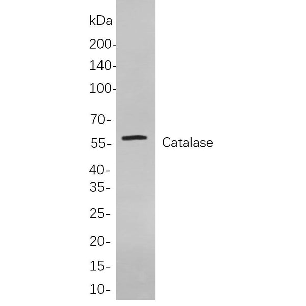 U-Blot® Catalase Rabbit Monoclonal Antibody – Figure 1 of 1
