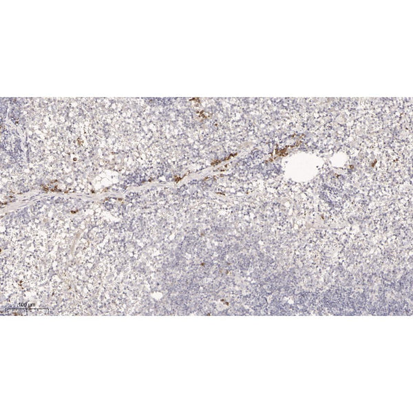 U-Blot® IL18 Rabbit Monoclonal Antibody – Figure 1 of 2