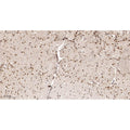 U-Blot® MeCP2 Rabbit Monoclonal Antibody – Figure 1 of 2