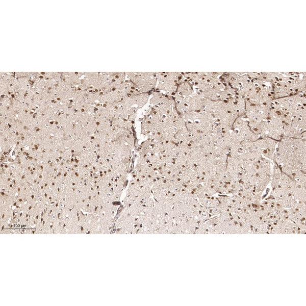 U-Blot® MeCP2 Rabbit Monoclonal Antibody – Figure 1 of 2