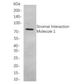 U-Blot® PKC α (Phospho Thr638) Rabbit Monoclonal Antibody – Figure 1 of 1
