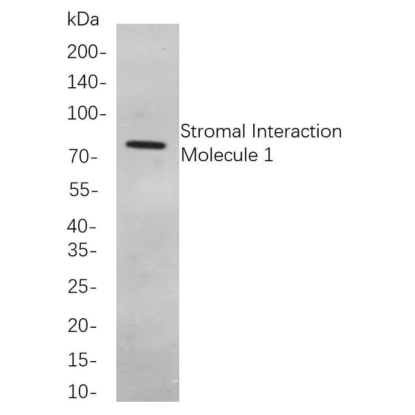 U-Blot® PKC α (Phospho Thr638) Rabbit Monoclonal Antibody – Figure 1 of 1