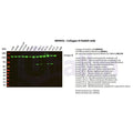 U-Blot® Collagen III Rabbit Monoclonal Antibody – Figure 1 of 4