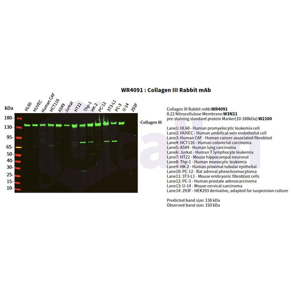U-Blot® Collagen III Rabbit Monoclonal Antibody – Figure 1 of 4