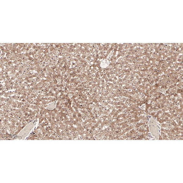 U-Blot® ACE2 Rabbit Monoclonal Antibody – Figure 1 of 2