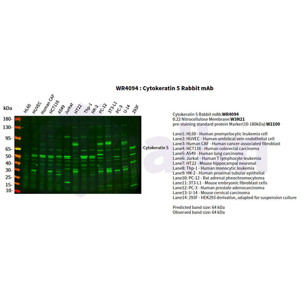 U-Blot® Cytokeratin 5 Rabbit Monoclonal Antibody – Figure 1 of 5