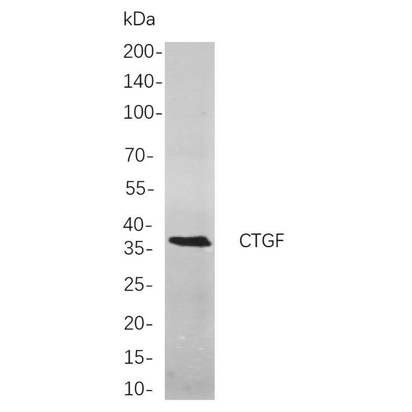 U-Blot® CTGF Rabbit Monoclonal Antibody – Figure 1 of 1