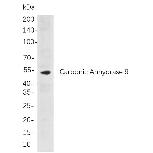 U-Blot® Carbonic Anhydrase 9 Rabbit Monoclonal Antibody – Figure 1 of 1