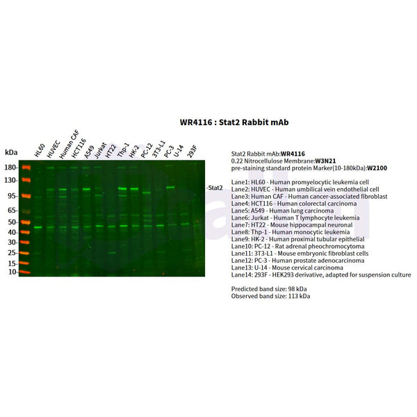 U-Blot® STAT2 Rabbit Monoclonal Antibody – Figure 1 of 5
