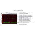 U-Blot® LC3B Rabbit Monoclonal Antibody – Figure 1 of 5