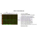 U-Blot® TSG101 Rabbit Monoclonal Antibody – Figure 1 of 2