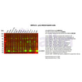 U-Blot® p16 INK4A Rabbit Monoclonal Antibody – Figure 1 of 2